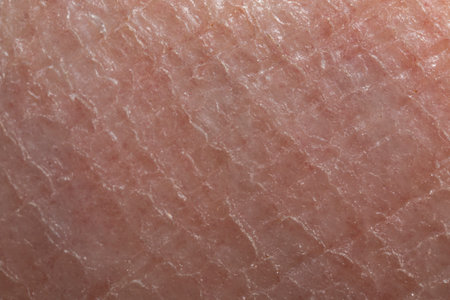 Skin diseases concept. macrophotograph of human skin under microscope, magnified 5x. Medicine and...