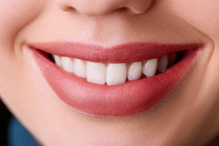 Closeup Beautiful young woman smile. Dental health. Teeth whitening. Restoration conceptの写真素材