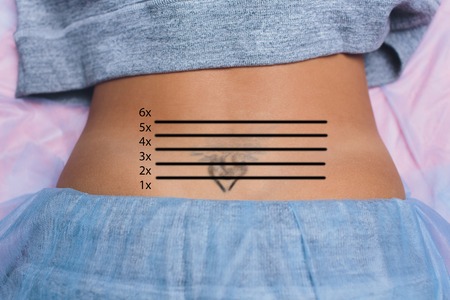 Cosmetologist with patient and professional tattoo removal laser in salonの写真素材