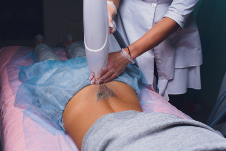 Cosmetologist with patient and professional tattoo removal laser in salon.の写真素材