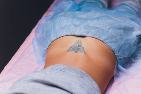 Cosmetologist with patient and professional tattoo removal laser in salon.の写真素材