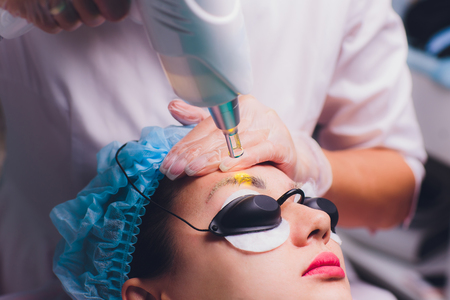 Laser removal of a permanent make-up on a face. Closeup young woman receiving correction of a tattoo on eyebrows procedure. Correction of natural imperfections on a face.の写真素材