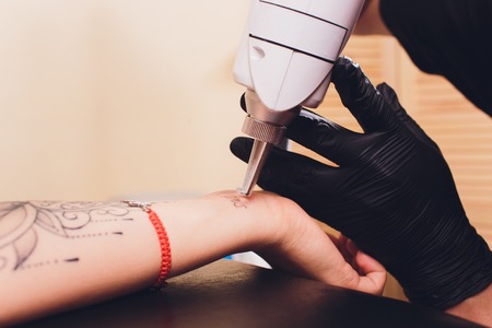 Cosmetologist with patient and professional tattoo removal laser in salon.