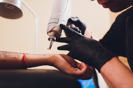 Cosmetologist with patient and professional tattoo removal laser in salon.の写真素材