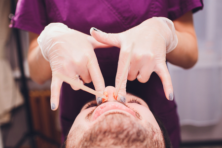 Hair removal. Mans face sugaring epilationsy ellow color, in cosmetology on the couch. hair removal inside the nose.の写真素材