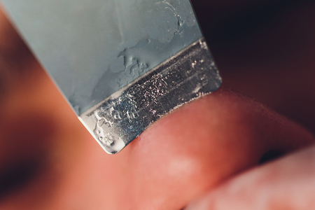 Ultrasonic face cleaning, young man. Work of cosmetologist close up. Skin care technologies research. Macro. nose procedureの写真素材