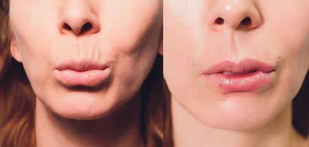 Close up of a hands threading beautiful womans upper lip.の写真素材