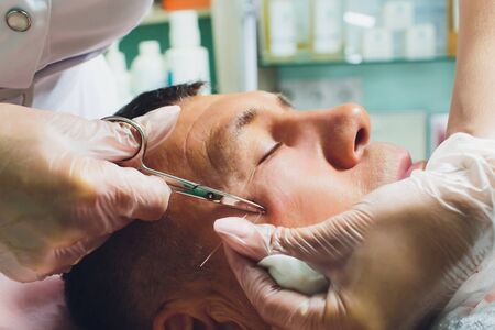 Close-up of procedure for face lifting PDO Suture operation, face lifting surgery. innovative technique of New thread lift, NovaThreads and Silhouette InstaLift mens bags under the eyes.の写真素材