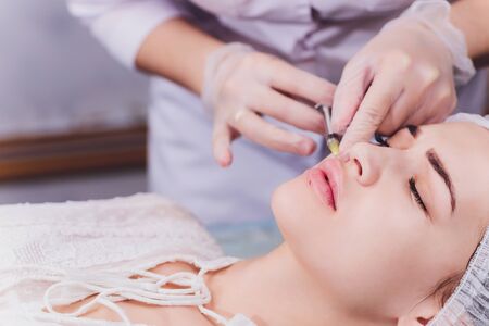 woman receiving a injection in her lips, close up.の写真素材