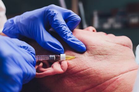 The hands of a plastic surgeon draw contours on the patients face. for the procedure of contour plasty of the face.の写真素材