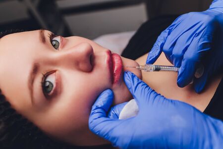 Young woman receiving a injection in her lips, close up.の写真素材