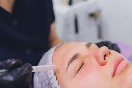 Woman cleaning nose skin pores using vacuum blackhead remover, cosmetic procedure.の写真素材