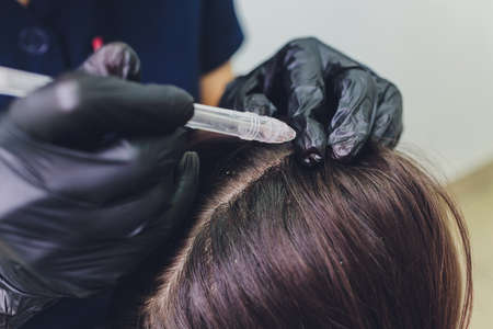 Gas-liquid hair peeling, dandruff cleansing. young woman.の写真素材