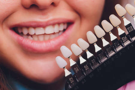 The dentist comparing patients teeth shade with samples for bleaching treatment.の写真素材