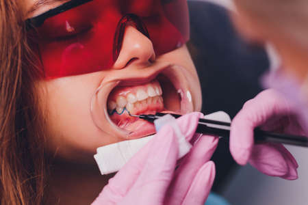 The dentist comparing patients teeth shade with samples for bleaching treatment.の写真素材