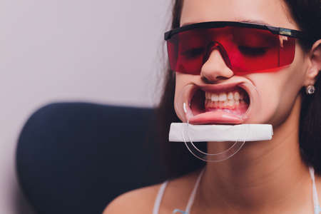 The dentist comparing patients teeth shade with samples for bleaching treatment.の写真素材