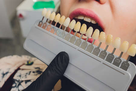 Close up portrait of Young women in dentist chair, Check and select the color of the teeth. Dentist makes the process of treatment in dental clinic office.Dentist.の写真素材
