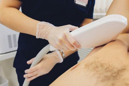 man receiving laser epilation at armpit on beauty center.の写真素材