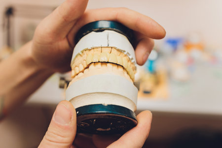 The process of making a dental prosthesis in a dental laboratory.の写真素材