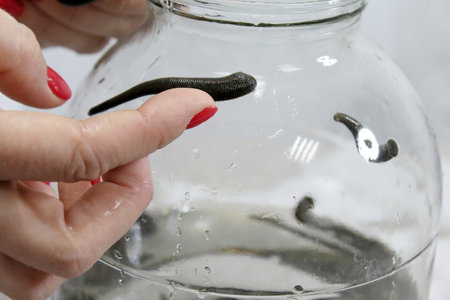 medical leech on the doctors gloved hand.