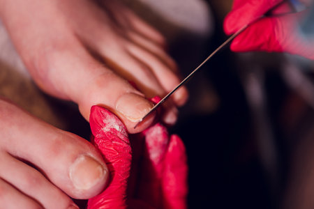 Therapeutic pedicure. Master podologist does hardware pedicure. visit to the podiatry. Foot treatment in the spa. Clinic of Podiatria.の写真素材