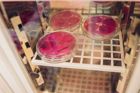 E. coli growing on a peri plate. Collected from a lettuce sample.