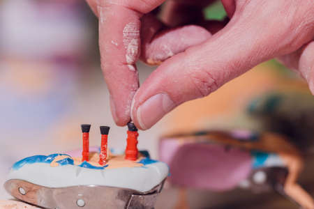 The process of making a dental prosthesis in a dental laboratory.