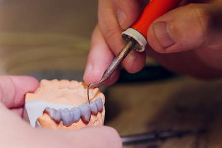 The process of making a dental prosthesis in a dental laboratory.の写真素材
