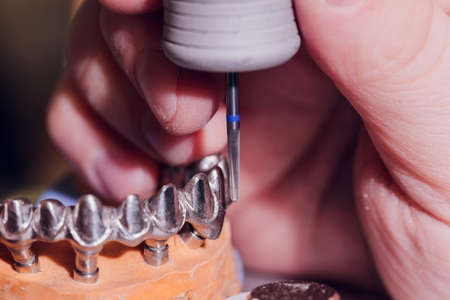 The process of making a dental prosthesis in a dental laboratory.の写真素材