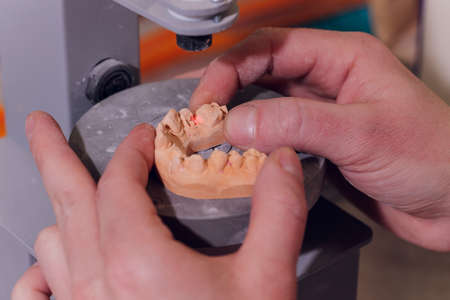 The process of making a dental prosthesis in a dental laboratory.の写真素材