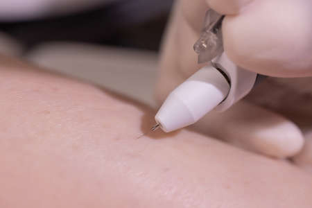 Female legs on purple sheet during epilation by a professional beautician in gloves. Spa, beauty...