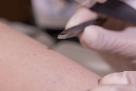 Female legs on purple sheet during epilation by a professional beautician in gloves. Spa, beauty...