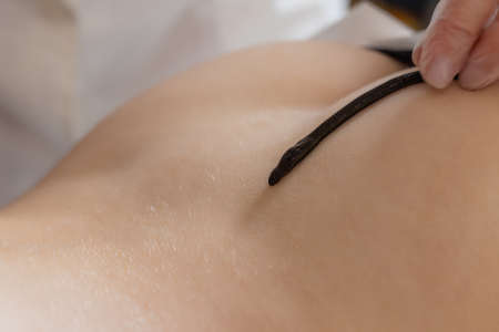 Traditional alternative medicine - doctor doing procedure of hirudotherapy for young woman.