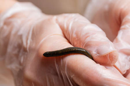 Traditional alternative medicine - doctor doing procedure of hirudotherapy for young woman.の写真素材
