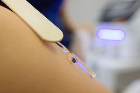Beautician Giving Epilation Laser Treatment To Woman On Thigh.