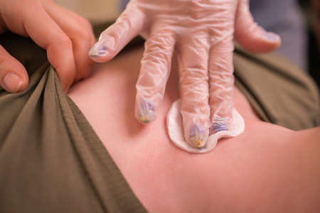 Operation to install microdermal piercing. Professional placingの写真素材