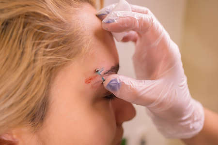 Professional placing the jewel of piercing on the temple on the head with ball. Tragus type.の写真素材