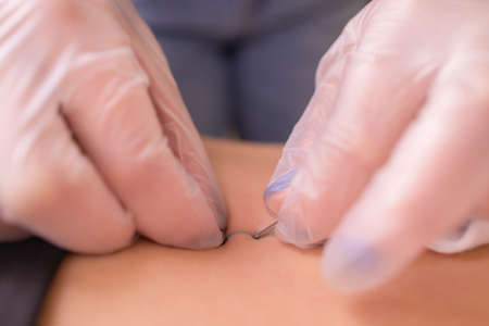 The first piercing. Dressing the earrings on the navel. Female piercing.の写真素材