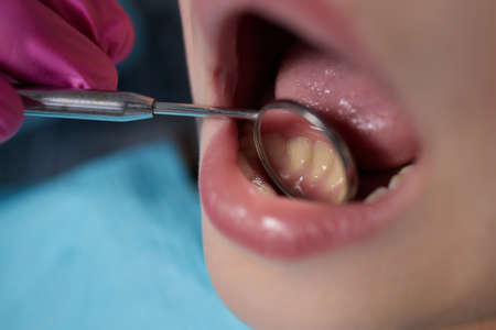 A close-up of a young girl getting a dental exam by dentist and using dental mirror to see baby teeth and gums.の写真素材