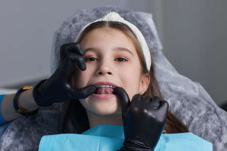 caucasian little kid girl invisible aligner and pointing to her perfect straight teeth. Dental healthcare and confidence concept.の写真素材
