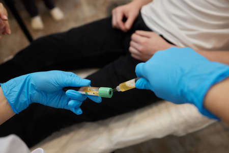 Beautician doctors hands put test tube with blood in centrifuge container. Rejuvenation plasmolifting procedure.の写真素材
