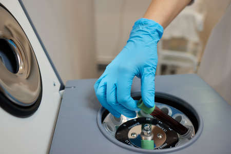 Beautician doctors hands put test tube with blood in centrifuge container. Rejuvenation plasmolifting procedure.の写真素材