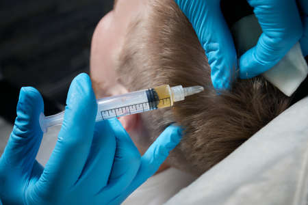 Injection plasma into head hair man cosmetologist doctor.の写真素材