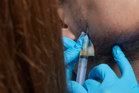 Injection plasma into beard hair man cosmetologist doctor.