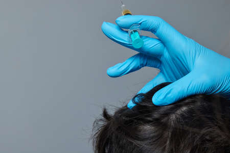 Injection plasma into head hair man cosmetologist doctor.