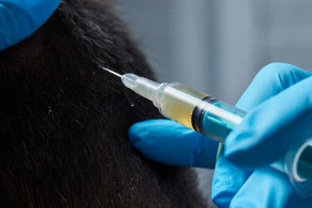 Injection plasma into head hair man cosmetologist doctor.の写真素材
