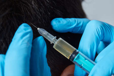 Injection plasma into head hair man cosmetologist doctor.の写真素材