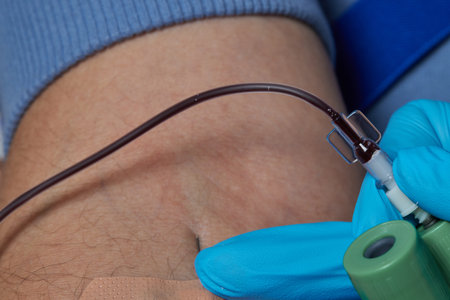 the doctor collects blood in a syringe, Nurse takes blood from the veins on the arm.の写真素材