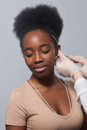 Close up of womans ear with pierced on her ear for treatment of the pain some place on her body by Chinese doctor.の写真素材