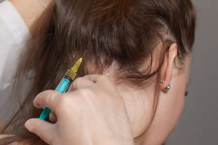 Plasma treatment, plasmolifting or PRP method point the introduction of the patients own plasma enriched with platelets, in the problem areas of the skin.の写真素材